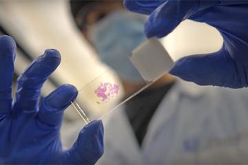 Beta cell research | The Wanek Family Project for Type 1 Diabetes | City of Hope
